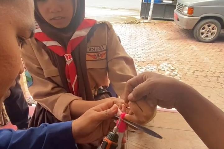 Proses Evakuasi Jari Siswi Tersangkut Gagang Sapu