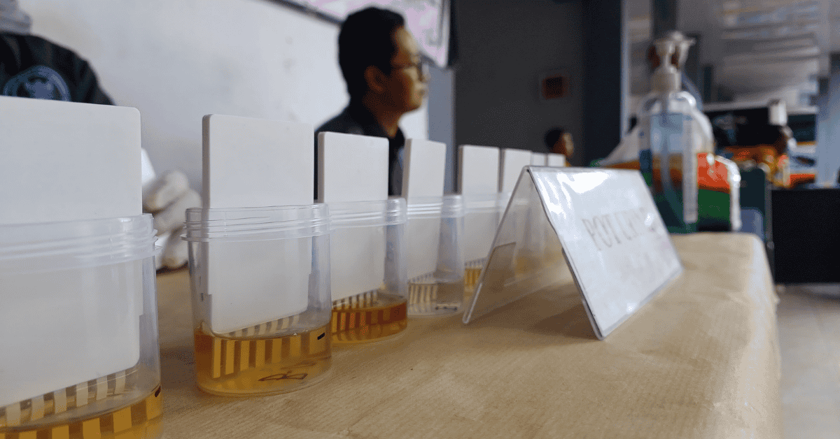 Hasil Tes Urine Terminal Tipe A Trenggalek