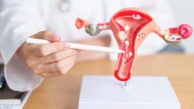 Dinkes Kota Blitar Catat 132 Kasus Kanker Serviks