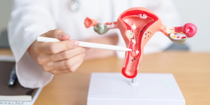 Dinkes Kota Blitar Catat 132 Kasus Kanker Serviks